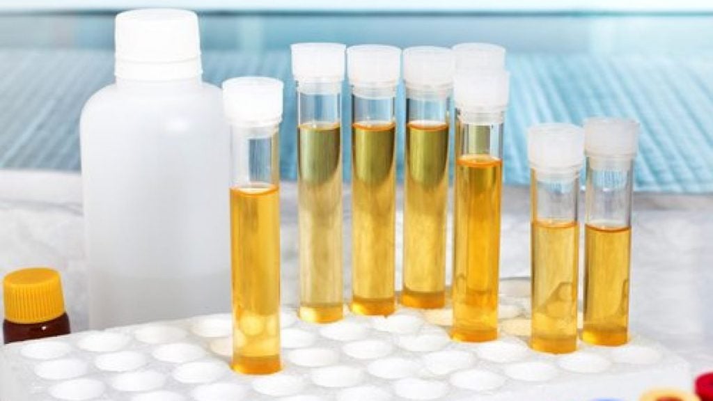 Can You Heat up Synthetic Urine More Than Once